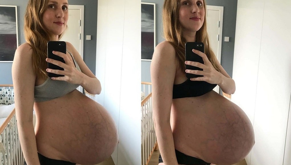 Zwanger van drieling