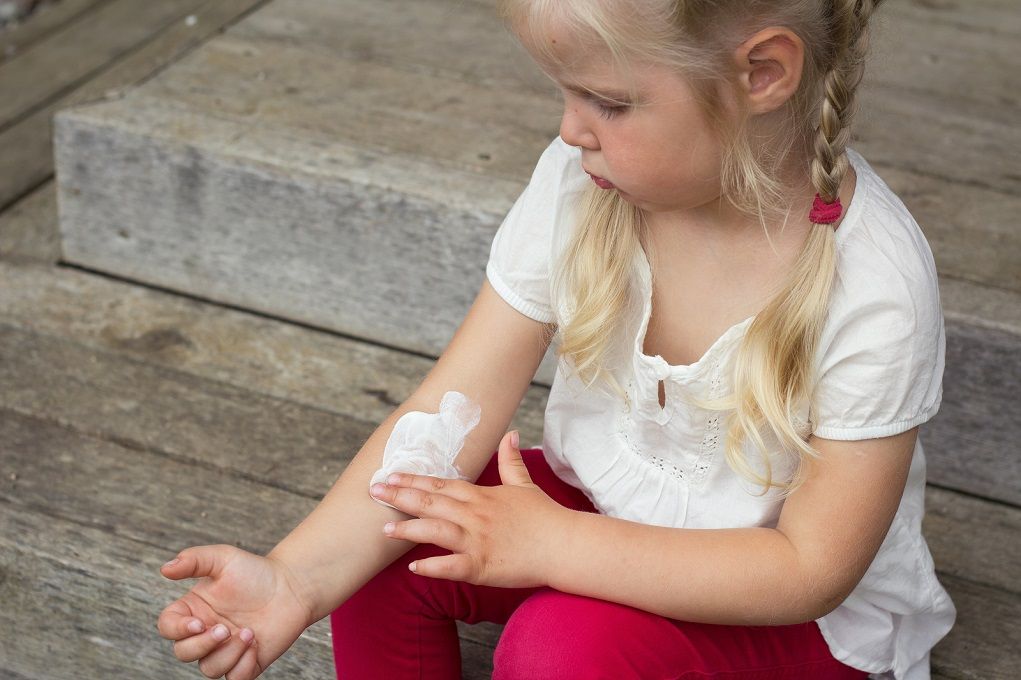Jong meisje smeert crème op haar arm met eczeem